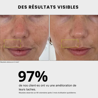 résultats visibles Routine anti-taches anti imprefection pour traiter l'acné, exces de sebum, cicatrices post-inflammatoire, tache solaire, melasma, hormonale, à l'acide kojique, curcuma, curcumine et niacinamide, vitamine B5, AHA et PHA Jeu De Peau